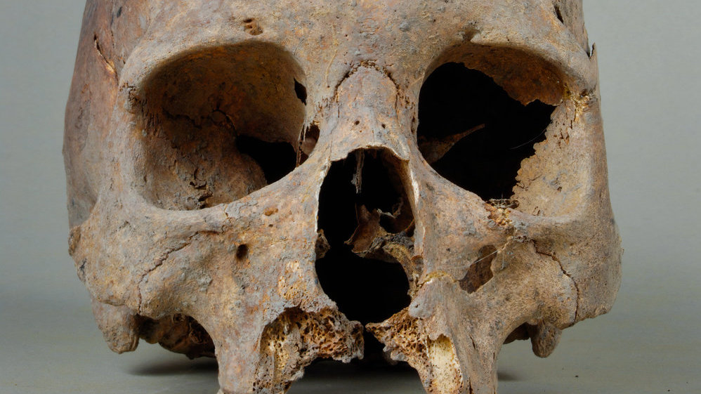 Die Syphilis Grassierte Wohl Schon Vor Kolumbus In Europa Nachricht Archaologie Online Department of biosciences, university of helsinki, helsinki, finland. die syphilis grassierte wohl schon vor